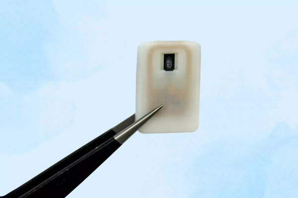 融股宝 MIT新型植入物：自动治疗1型糖尿病患者危险低血糖